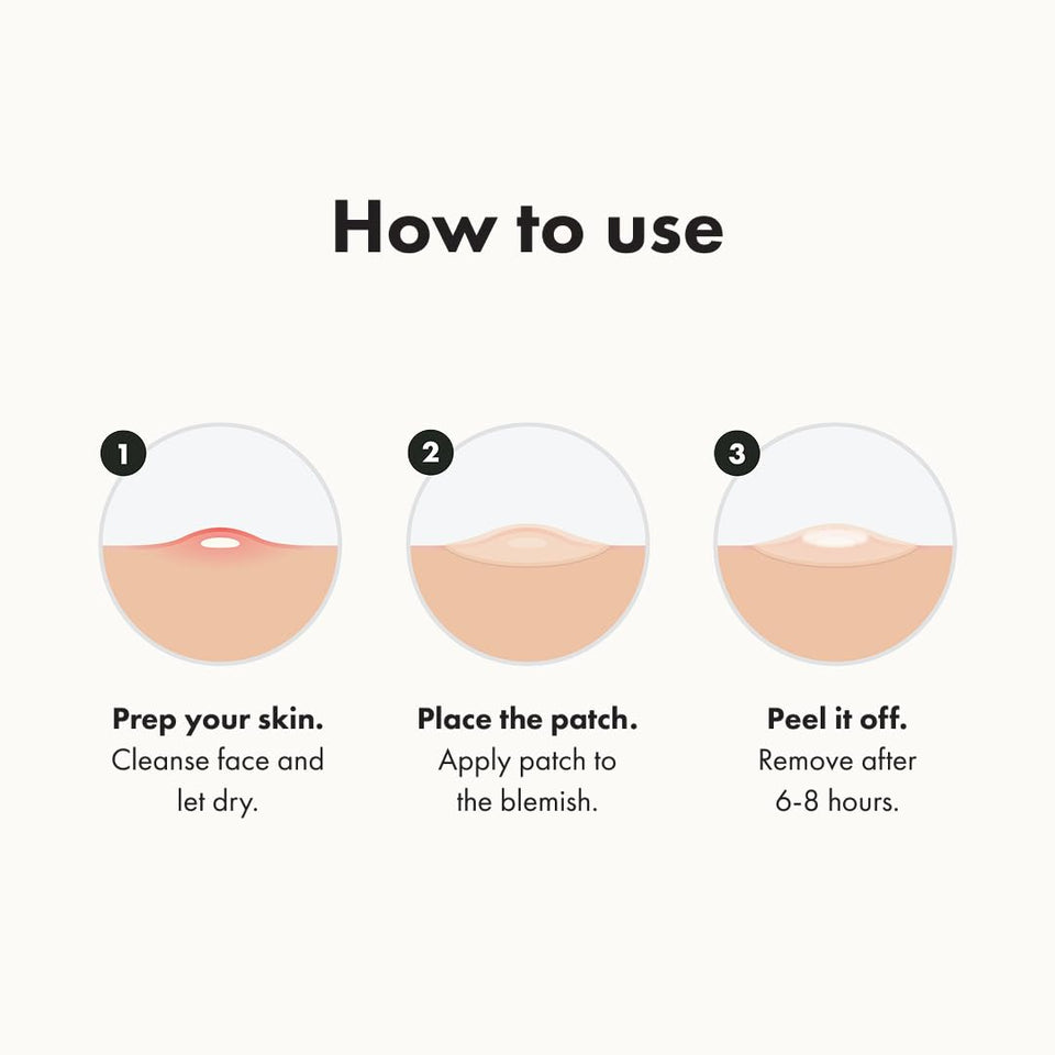 Mighty Patch Original acne pimple patches from Hero Cosmetics for shrinking zits and whiteheads in 1 use (36 Count)
