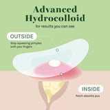 AOA Studio 84-count Hydrocolloid Acne Patches, Vegan, Cruelty-Free, 10mm, 12mm Sizes, Spot Treatment for Blemishes and Acne