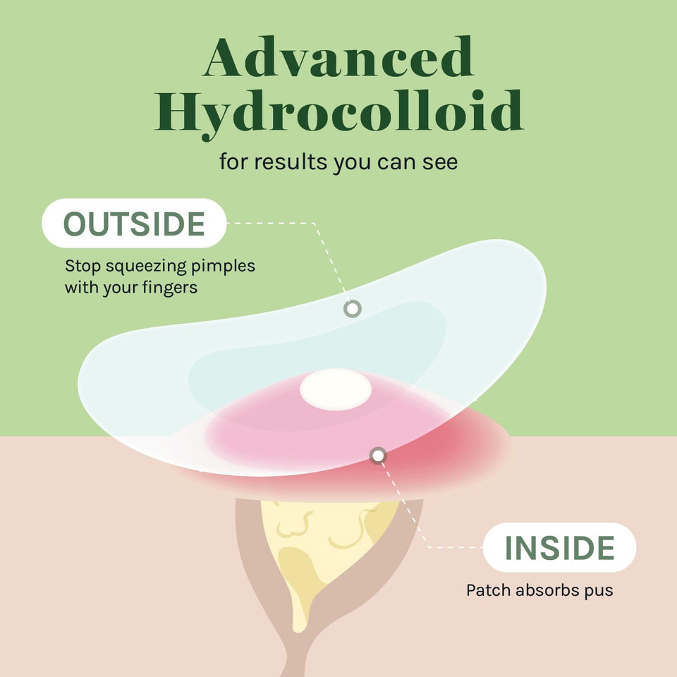 AOA Studio 84-count Hydrocolloid Acne Patches, Vegan, Cruelty-Free, 10mm, 12mm Sizes, Spot Treatment for Blemishes and Acne