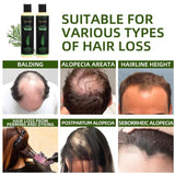 Tgideas Organic Rosemary Hair Growth Shampoo for Women and Men-Natural Thickening & Strengthening Shampoo with Hydrolyzed Keratin for Thinning Hair & Hair Loss 7.4 fl.oz