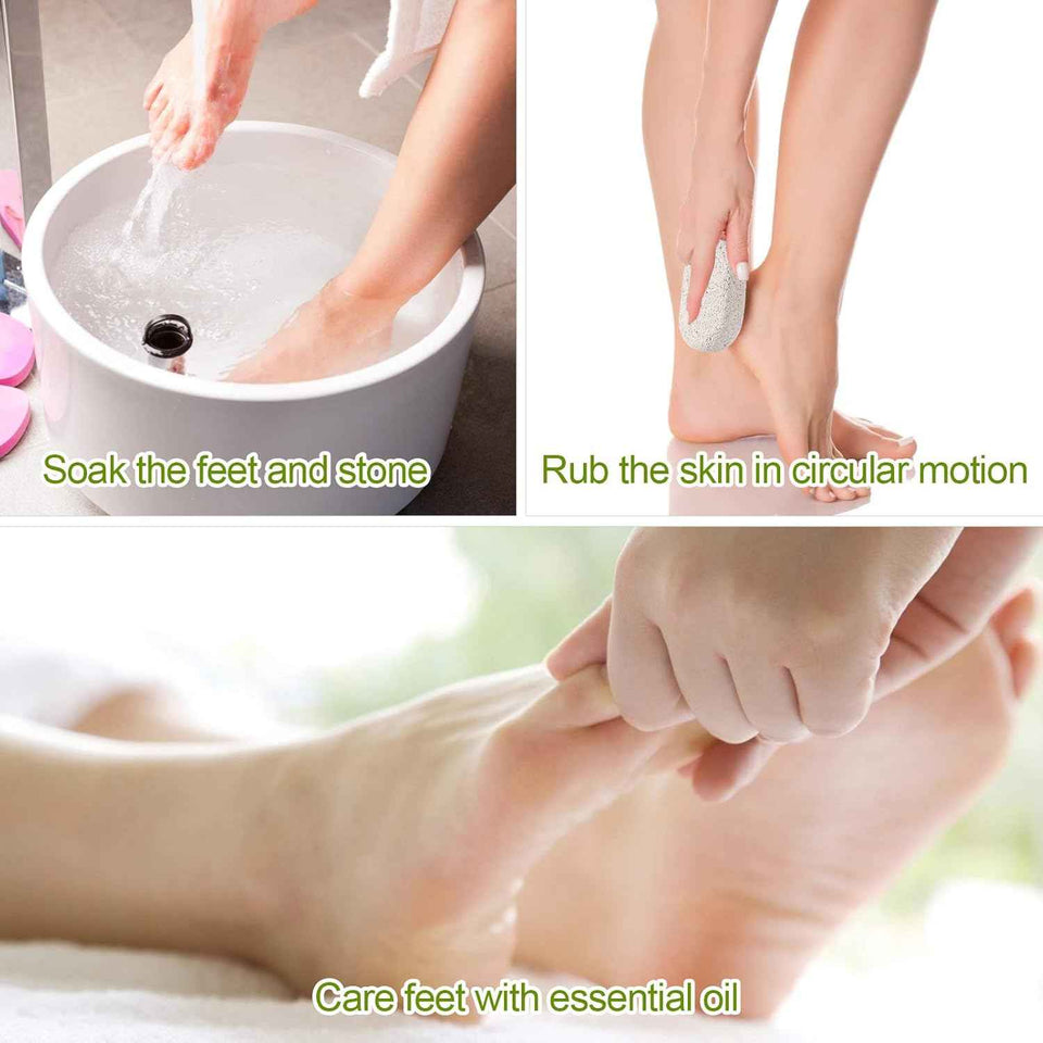Asqraqo Natural Pumice Stone Pedicure Tools for Foot & Hand Callus Removal