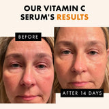 eclat skincare vitamin c serum 1 fl oz face care with hyaluronic acid and ferulic acid