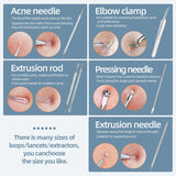 jpnk blackhead remover tool comedones extractor acne removal kit for blemish whitehead popping 6 pc zit removing for nose face tools with leather bag