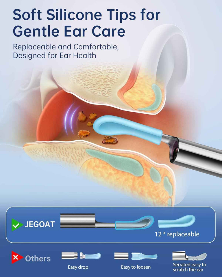 Jegoat ear wax removal kit with 1296p hd camera, 6 led lights and 10 ear pick for ios and android black