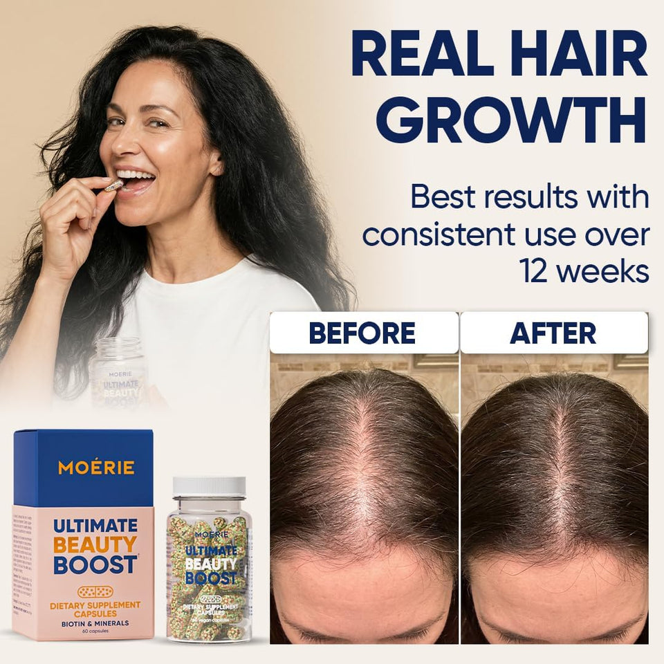 Moerie Ultimate Hair Growth Supplements for Women & Men - Hair, Skin, Nails Vitamins with Biotin & Minerals for Hair Health - Thicker Hair - 60 Capsules