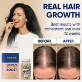 Moerie Ultimate Hair Growth Supplements for Women & Men - Hair, Skin, Nails Vitamins with Biotin & Minerals for Hair Health - Thicker Hair - 60 Capsules