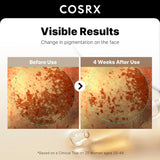 COSRX 2% Alpha Arbutin Discoloration Care Face Serum with Niacinamide, Glutathione & Tranexamic Acid, Dark Spot, Uneven Tone Care, Daily Korean Skin Care for Men and Women, 1.7 fl oz