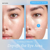 belif Aqua Bomb Cooling Eye Gel - Caffeine & Hyaluronic Acid for Puffiness & Hydration, Niacinamide & Vitamin C for Dark Circles, Adenosine & Collagen for Plumping, Korean Skin Care, 0.5 fl oz (15ml)