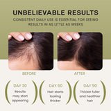 Lebanta Batana Oil For Hair Growth - 100% Pure, Raw & Natural Blend With Organic Castor, Pumpkin Seed, Coconut and Rosemary Oil - Thicker, Stronger Hair Gifts For Men & Women Scalp (1 Pack)