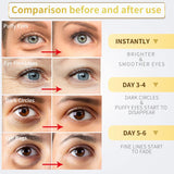 24K Gold Under Eye Patches - 60 Pack for Puffy Eyes, Dark Circles, Bags & Wrinkles with Collagen & Hyaluronic Acid - Eye Care Pads for Daily Skincare (Gold)