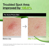 anua azelaic acid 10 hyaluron redness soothing serum for sensitive skin, korean skincare, vegan, 30ml, 1.01 fl oz.