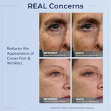 Plexaderm Rapid Reduction Eye Serum - Visibly Reduces Under-Eye Bags, Wrinkles, Dark Circles, Fine Lines & Crow's Feet Instantly, Anti Aging Wrinkle Remover for Face, Full Size Tube