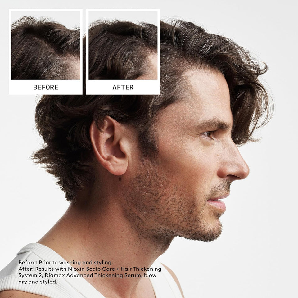 Nioxin System 2 Scalp + Hair Thickening Shampoo for Natural Hair with Progressed Thinning | Cleanse & Boost Hair Density with Niacinamide & Biotin